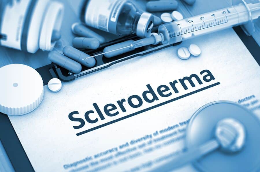 Elderly Care in Rockridge CA: Scleroderma